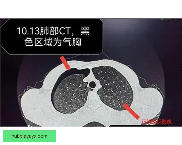 坎宁安气胸恢复顺利 活塞官方公布复查时间和复出计划